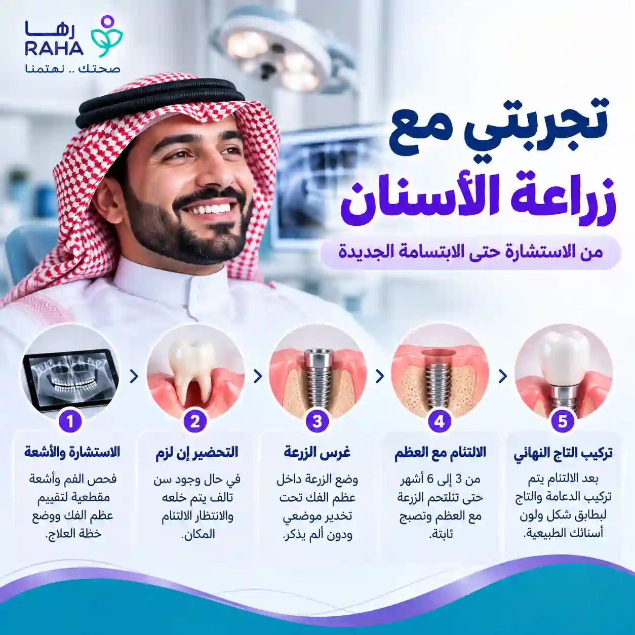 تجربتي مع زراعة الاسنان